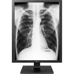 LG Electronics-21HK512D-B