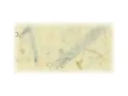 DALITE SCREEN COMPANY, INC-93166